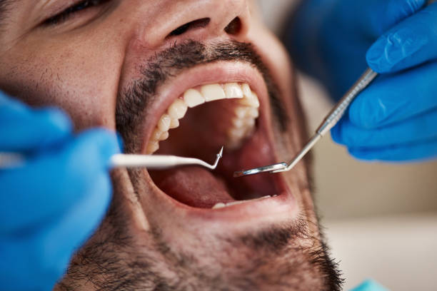 Best Urgent Care for Lost Fillings or Crowns in La Porte City, IA